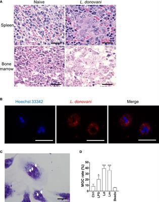 Leishmania infection-induced multinucleated giant cell formation via upregulation of ATP6V0D2 expression